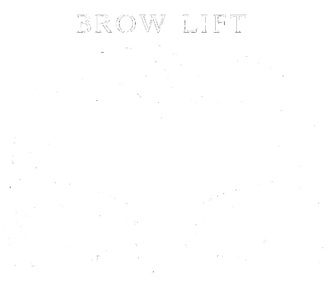 Brow lift Brow lift